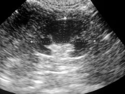 Przykładowy obraz USG